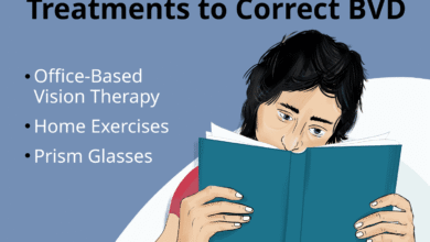 bvd eye test uk